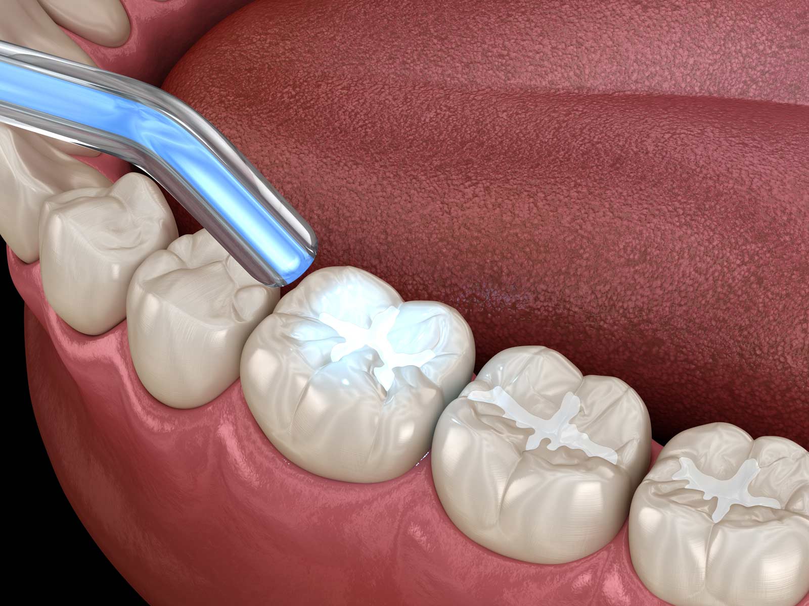 Restorative Dental Services in London, Ontario